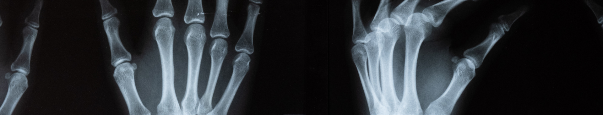 Baby Check Desarrollo